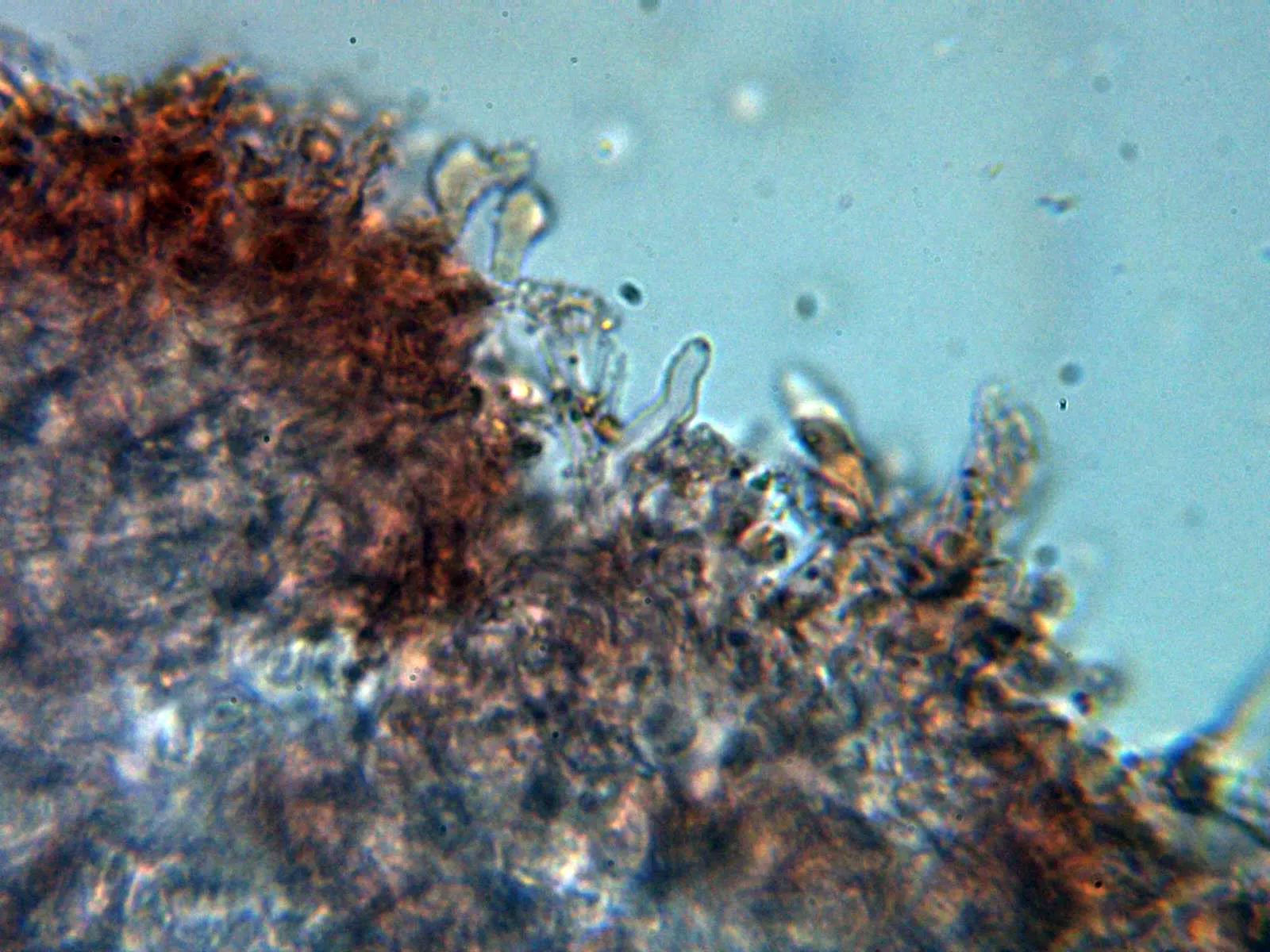 Microscopía de Sistotrema brinkmannii - 12 - Himenio 3